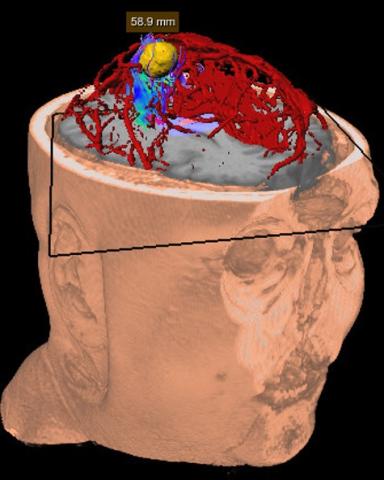 Skull visualization